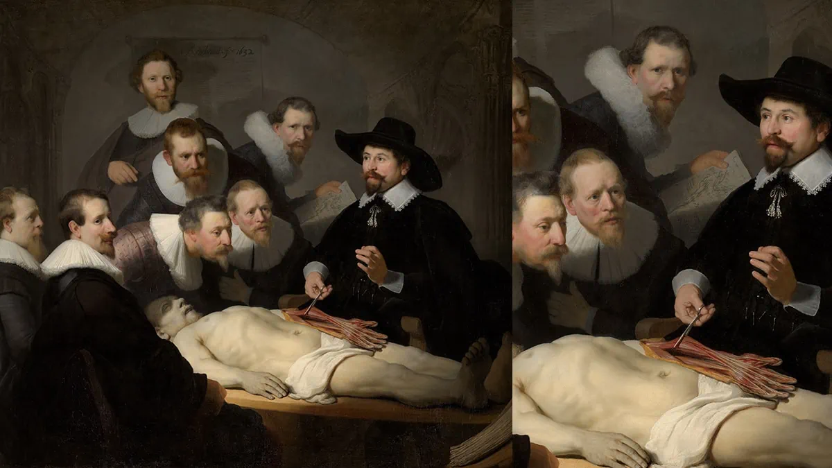 The Anatomy Lesson of Dr Nicolaes Tulp one of the famous Rembrandt paintings.